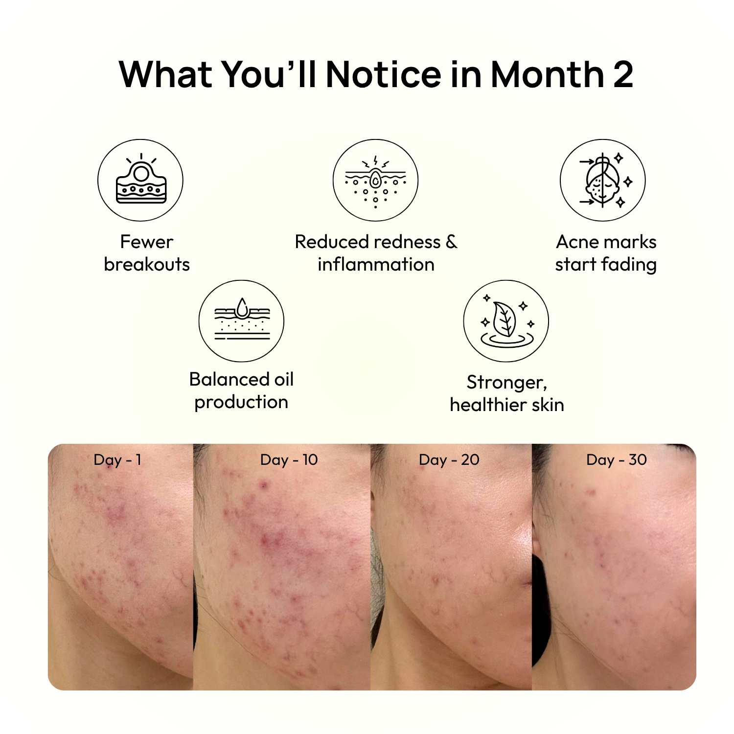 Stage 1: 2nd Month – Skin Balance & Repair
