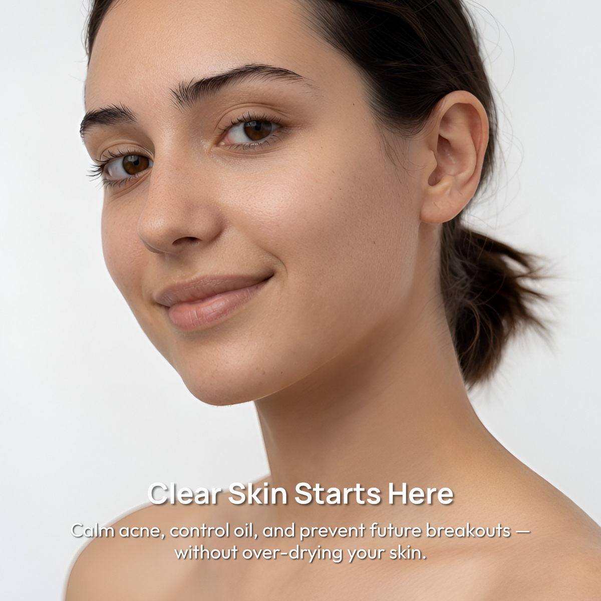 Acne Calm Serum