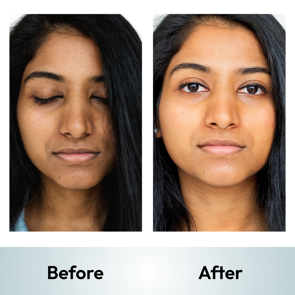 UV-Pur Sunscreen Gel (SPF 50+ PA++++)