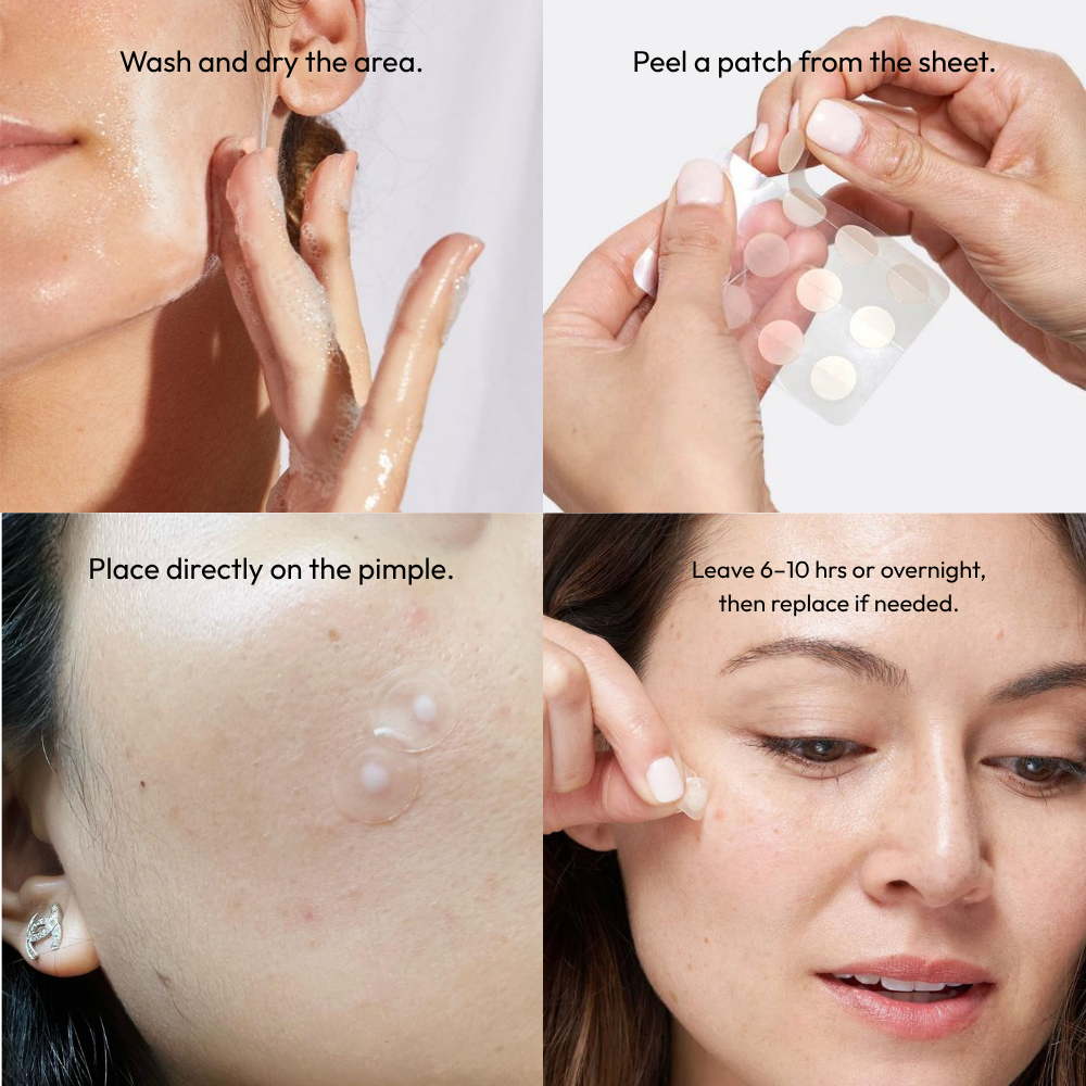 36 Dot Rescue Acne Patch