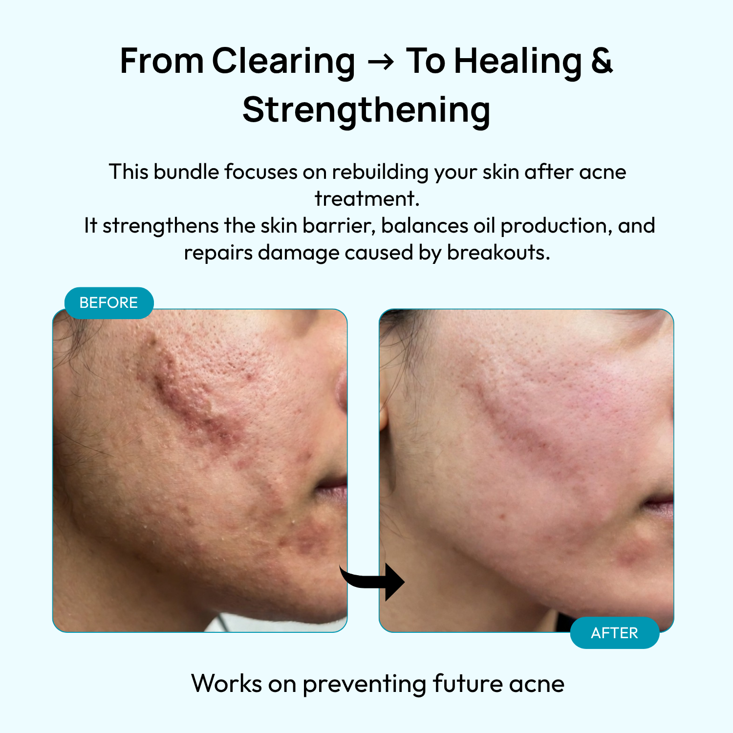 Stage 1: 2nd Month – Skin Balance & Repair
