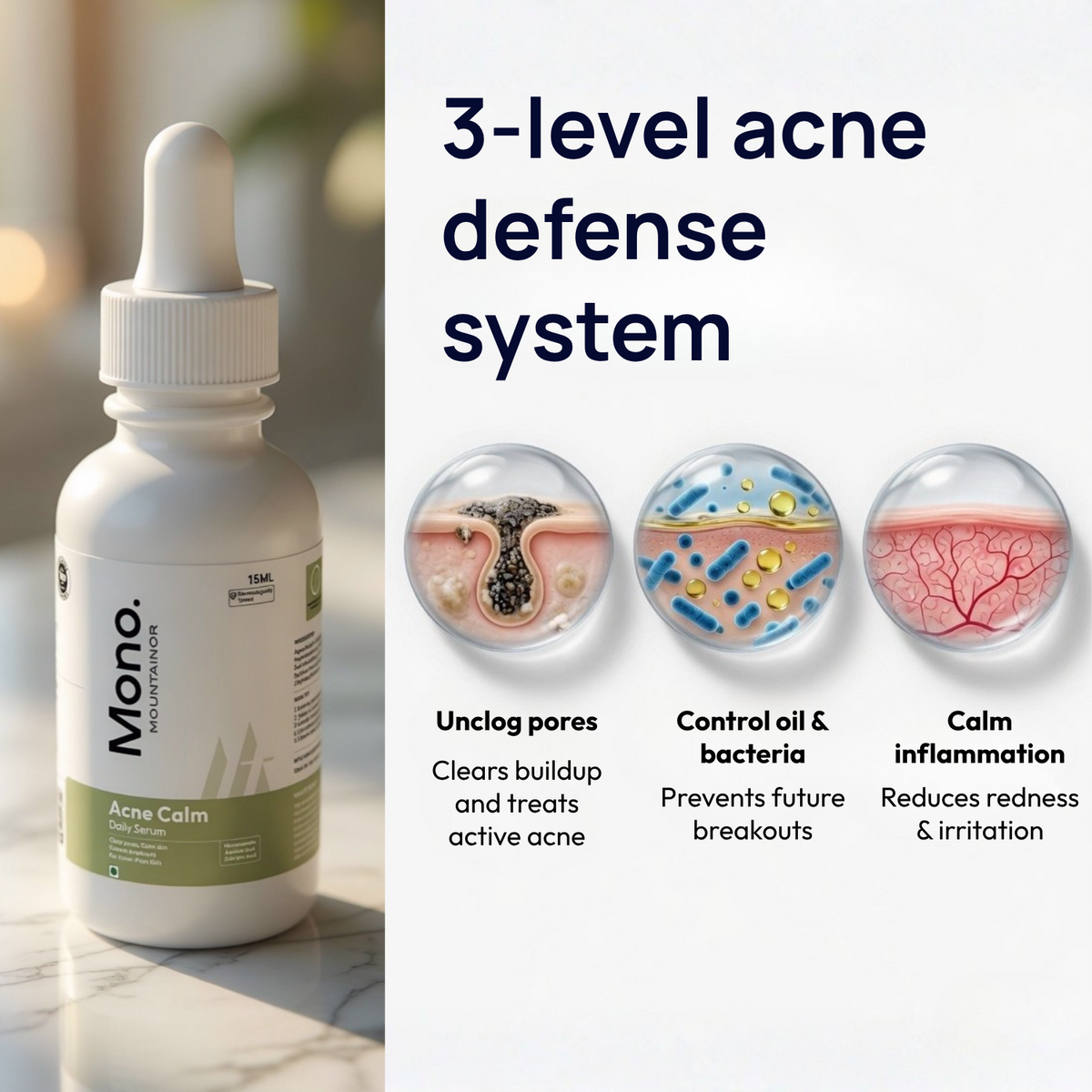 Acne Calm Serum