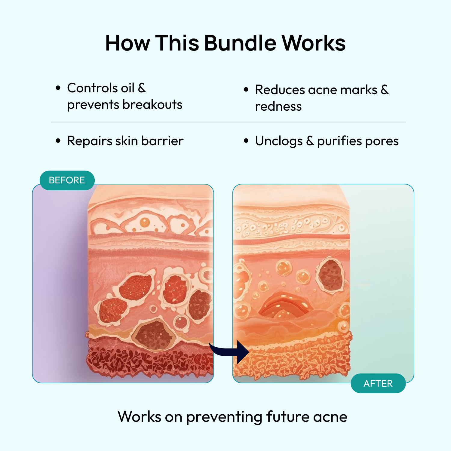 Stage 4 (POST-ACNE MARKS & SCARS): 90-Day Acne Recovery Plan
