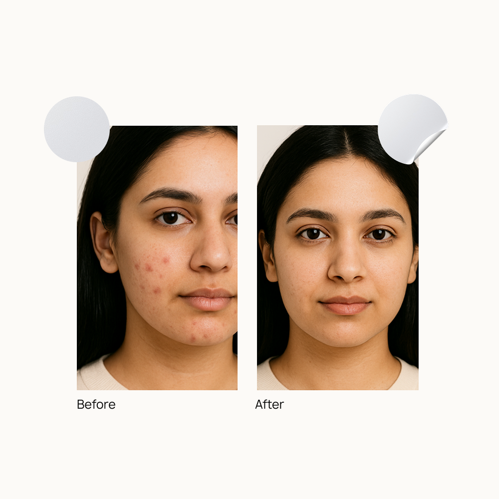 72 Dot Rescue Acne Patch
