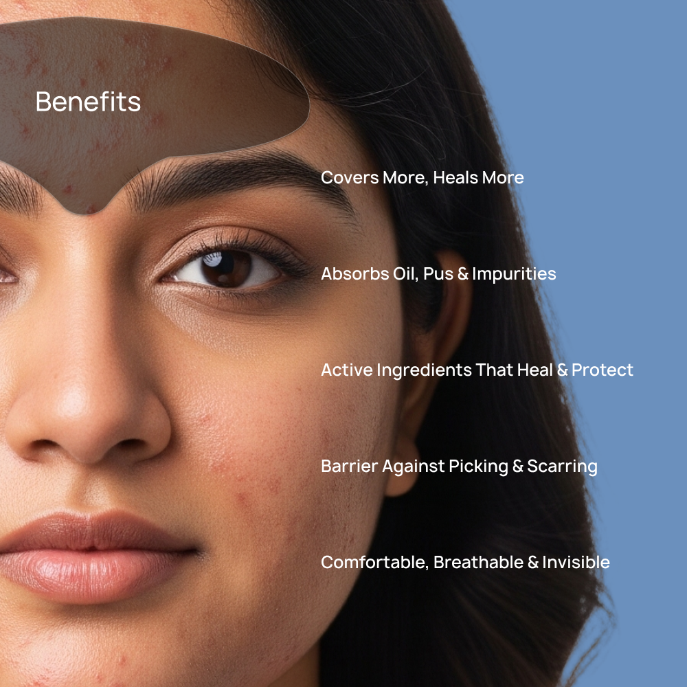 Forehead Acne Rescue Patch