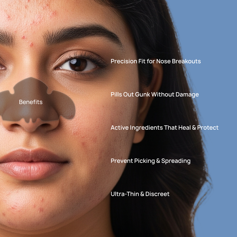 Nose Acne Rescue Patch