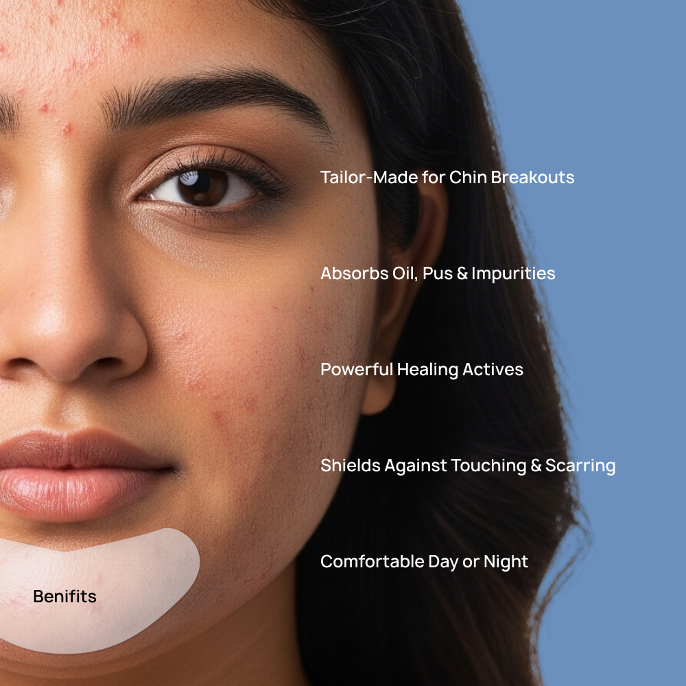 Chin Acne Rescue Patch