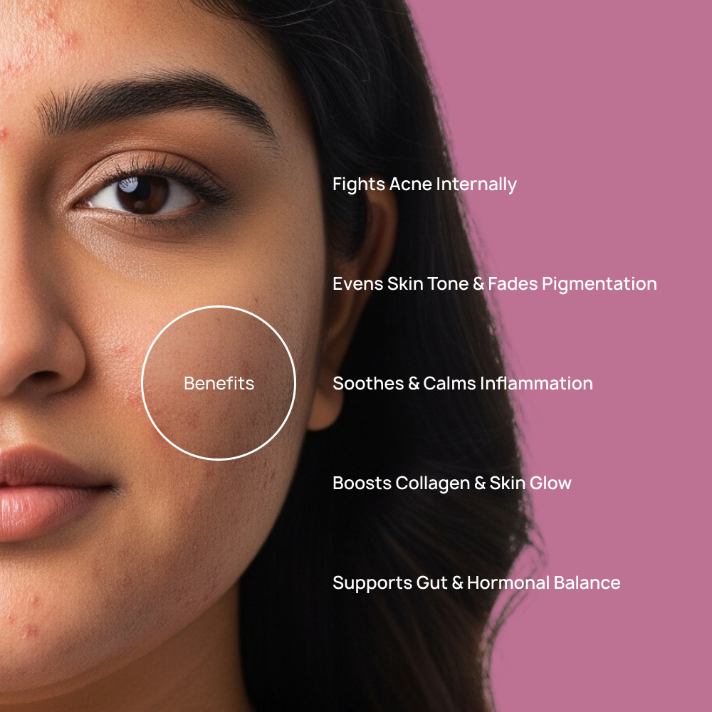 Acne Healing Pack for 2 Months