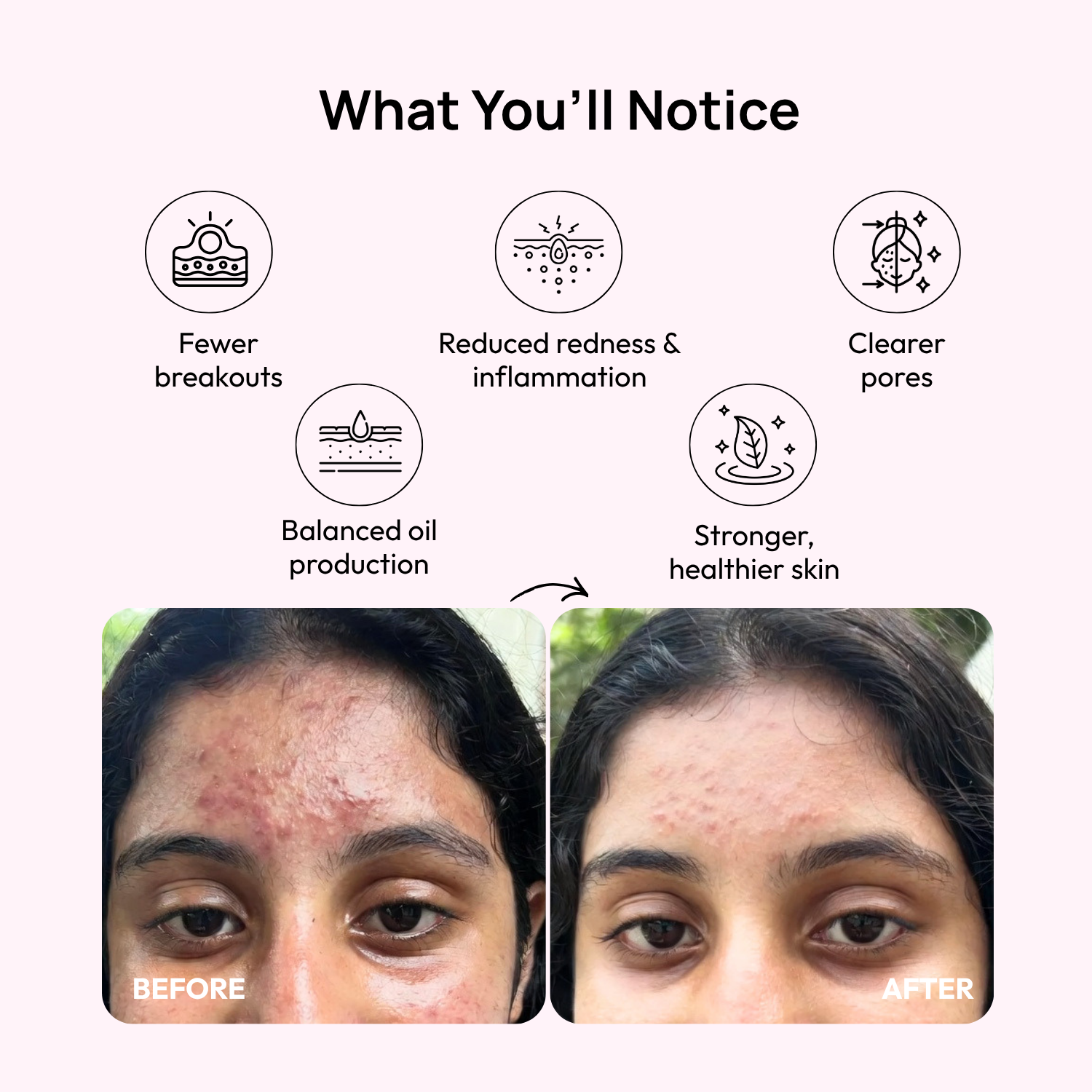 Stage 4:Month 3 – Smooth &amp; Strengthen