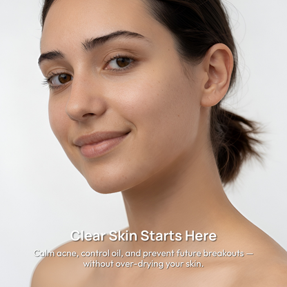 Acne Calm Serum