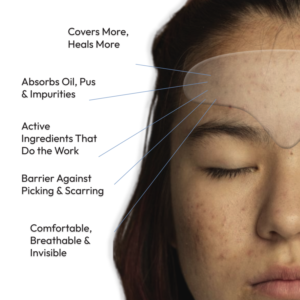 Rescue Forehead Patch