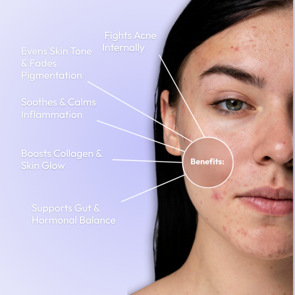 Mono Clear+ Inside: Acne Healing Pack