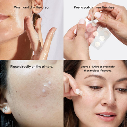 36 Dot Rescue Acne Patch