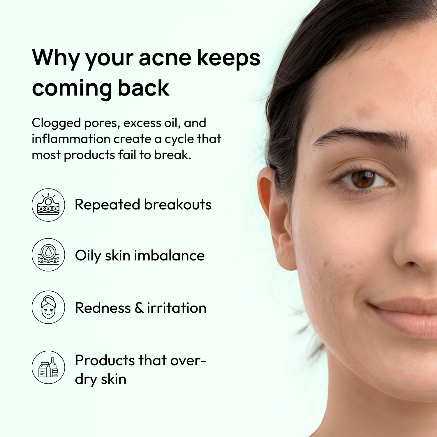 Acne Calm Serum