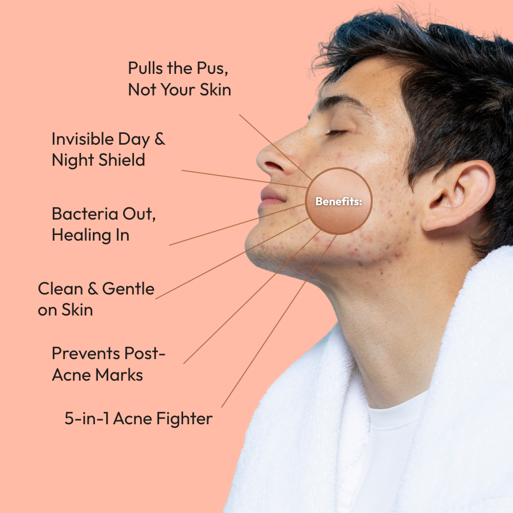 Mono Rescue: Acne Patch 36