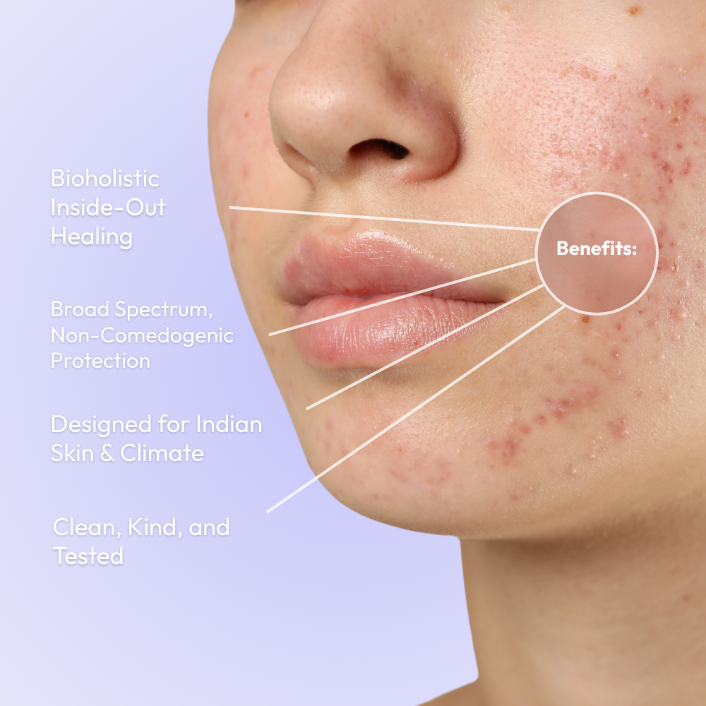 Acne Action Kit