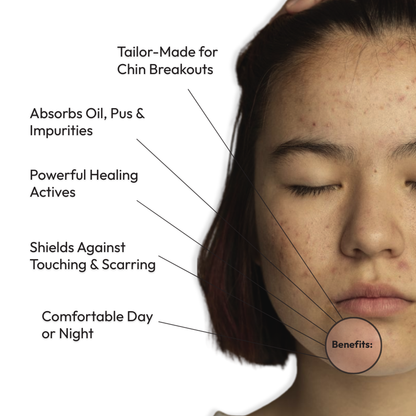 Mono Rescue Chin Acne Patch