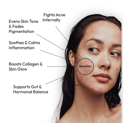 Mono Rescue+: One Month Acne Patch Plan