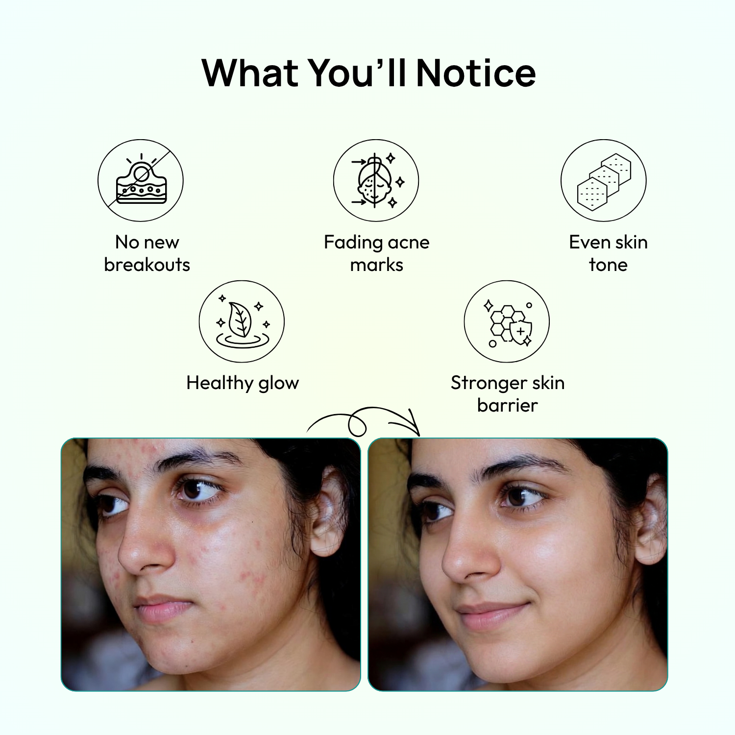 Stage 1: 3rd Month – Maintenance &amp; Glow