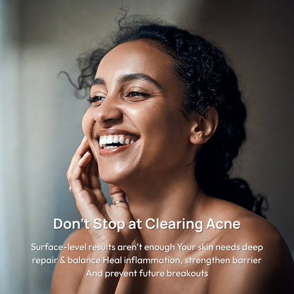 Stage 4 (POST-ACNE MARKS &amp; SCARS): 90-Day Acne Recovery Plan