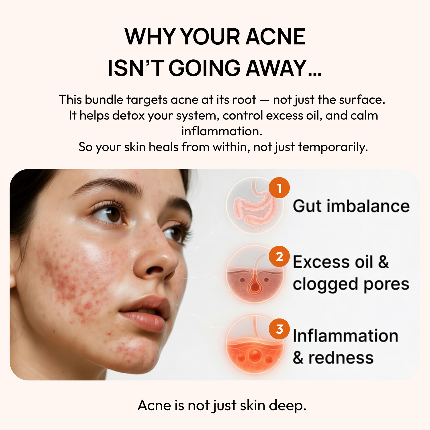 Stage 1 (Clog &amp; Congestion): 90-Day Skin Clarifying Plan