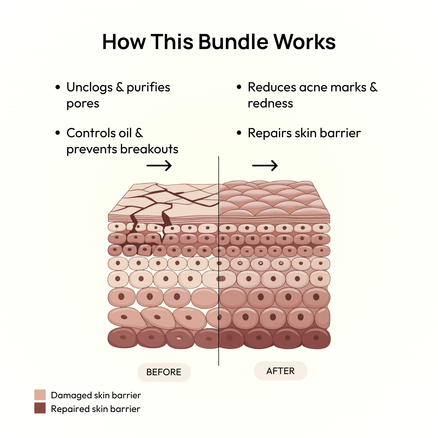 Stage 4 (POST-ACNE MARKS &amp; SCARS): 90-Day Acne Recovery Plan