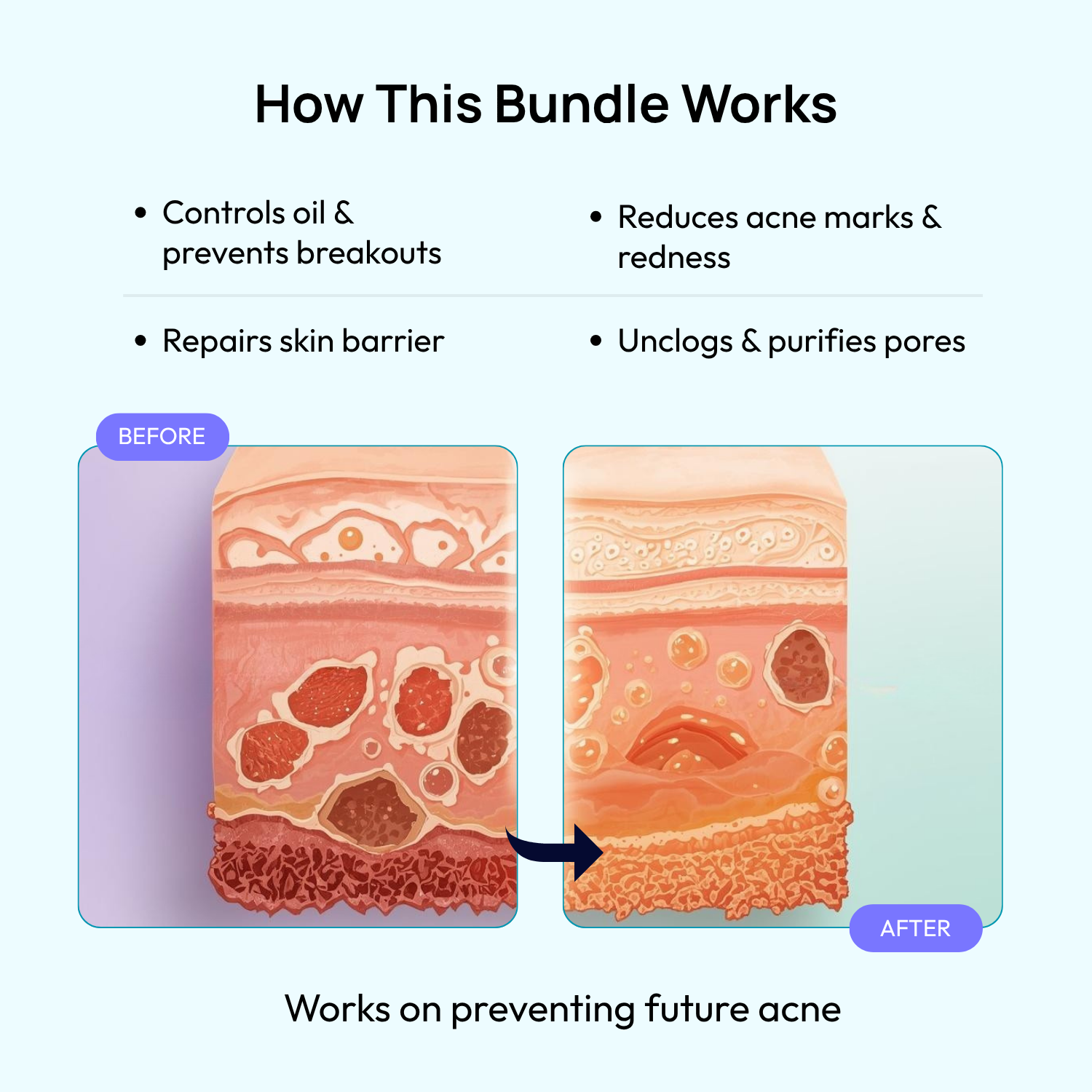 Stage 2 (Active Surface Breakout) : 90 Day Skin Transformation Plan