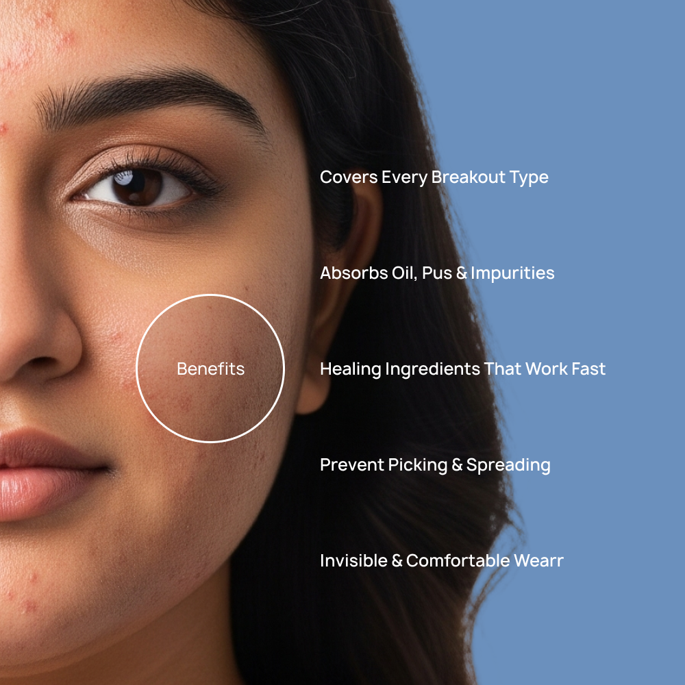 Pack Of 5  (1 Forhead 2 Nose 2 Chin)