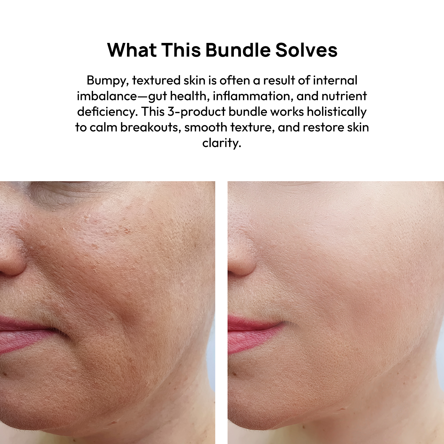 STAGE 1: Clear Biotics + Himalayan SeaBuckthorn