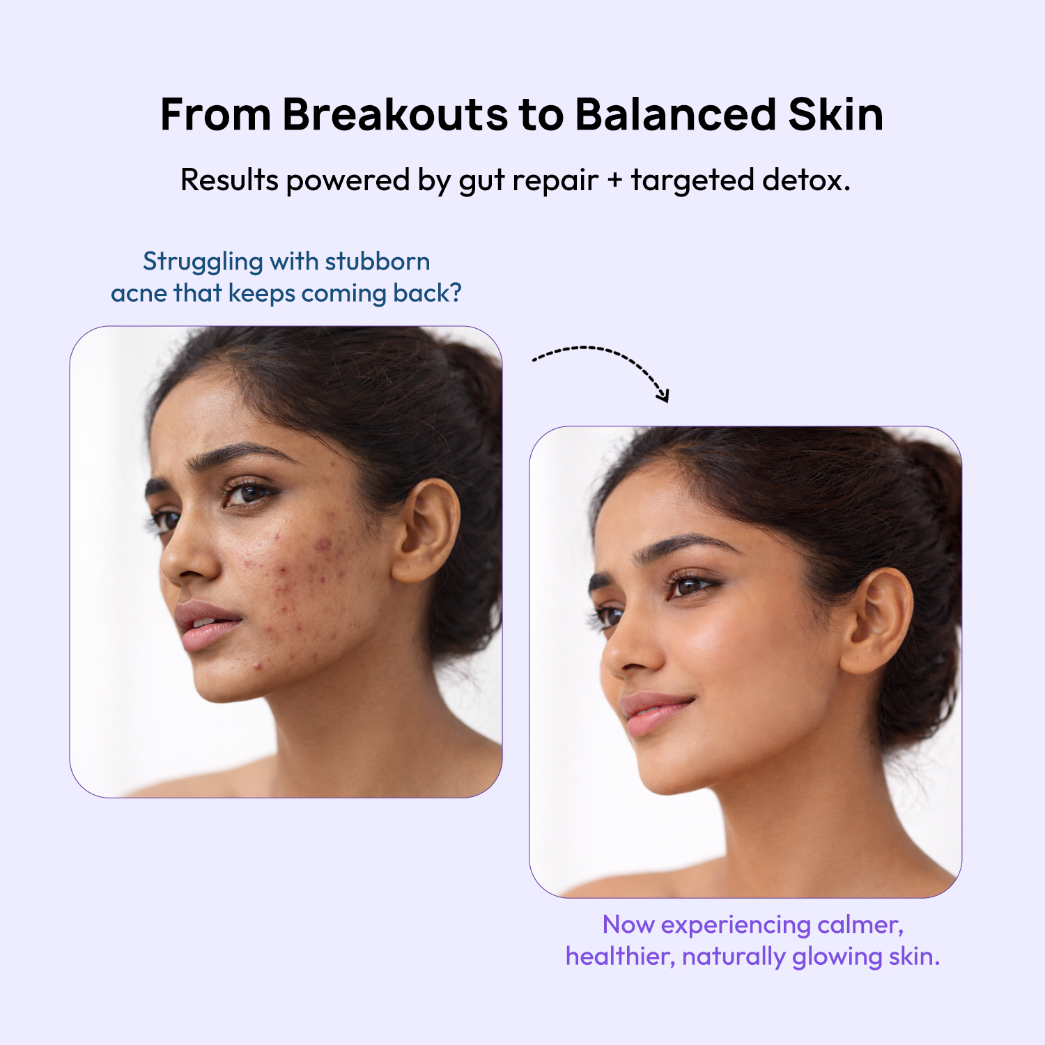 STAGE 2: ClearBiotics + Himalayan SeaBuckthorn+ &amp; Clarity